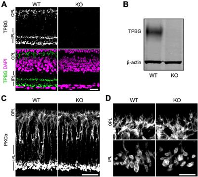 Trophoblast glycoprotein is required for efficient synaptic vesicle exocytosis from retinal rod bipolar cells
